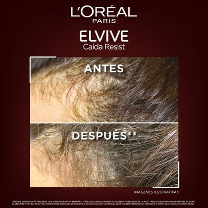 Resultados del Acondicionador Aminexil Centroamerica. Antes y Después: Cabello más denso y cuero cabelludo menos visible
